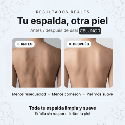 Toalla Exfoliante Piel Sensible Celunor™
